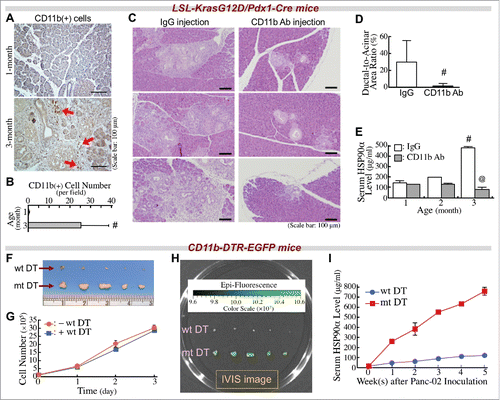 Figure 2. Infiltrating CD11b+-myeloid cells are involved in PDAC carcinogenesis and elevation of serum HSP90α levels in LSL-KrasG12D/Pdx1-Cre mice. (A) Immunohistochemical images showing CD11b+-myeloid cells (red arrows) infiltrating into the pancreatic tissues of LSL-KrasG12D/Pdx1-Cre mice at 3 months of age. (B) Quantification of CD11b+ cells from the pancreatic tissues of LSL-KrasG12D/Pdx1-Cre mice at 1 and 3 months of age. #, P < 0.05 when compared with the data of 1-month-old mice. (C) Retardation of the ADM development in LSL-KrasG12D/Pdx1-Cre mice upon treatment with anti-CD11b antibody as described in Materials and Methods. The mice were sacrificed at 3 months of age, and their pancreatic tissue sections were stained with H&E to identify ADM status. (D) Quantification of ADM levels by calculating the ratios of ductal regions to acinar regions in the pancreatic tissue sections of LSL-KrasG12D/Pdx1-Cre mice treated as described in (C). (E) Reduction of serum HSP90α levels in LSL-KrasG12D/Pdx1-Cre mice upon treatment with anti-CD11b antibody as described in (C). #, P < 0.05 when compared with the average serum HSP90α level of mice at 1 month of age. @, P < 0.05 when compared with the average serum HSP90α level of mice administered control IgG. (F) Inhibition of the tumor formation of Panc-02 cell grafts in CD11b-DTR-EGFP mice upon treatment with wild-type (wt) but not with mutant (mt) DT as described in Methods. (G) No significant inhibition of Panc-02 cell proliferation by wt DT treatment. After incubation with 2.5 nM of wt DT for 1, 2, or 3 days, the cells excluding trypan blue were counted for plotting the cell proliferation curves. (H) Infiltrating CD11b+-myeloid cells were detected in the tumor masses of mt DT-treated mice by using an IVIS imaging system. (I) HSP90α levels in sera of mice treated as described in (F). Sera were collected every week after the Panc-02 cell inoculation.