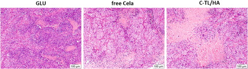 Figure 10. Representative images of the HE-stained tumor sections after treatment with GLU, Free Cela and C-TL/HA.