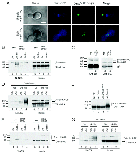 Figure 1. Effects of Dma on septin proteins. (A) Cells expressing endogenous-tagged Shs1-CFP and YFP-Dma2C451A were grown to mid-log, fixed and analyzed. Unsplit septin ring (top) and split septin ring (bottom) are presented (scale bar is 5 μm). (B) WT and dma1∆ dma2∆ cells expressing Shs1-HA and overexpressing Ub or His-Ub were purified and blotted with anti-HA. Protein markers (kDa) are on the left. (C) WT and dma1∆ dma2∆ cells expressing Shs1-HA were purified and blotted with anti-Ub (left); the blot was stripped and reprobed with anti-HA (right). (D) WT cells expressing GAL-Dma2, Shs1-HA and overexpressing Ub or His-Ub were analyzed as in (B). (E) Shs1-TAP was purified from yeast extracts and resuspended in 10 μl of ubiquitylation buffer containing E1 and E2 enzymes, ubiquitin, ATP and recombinant Dma2 or Dma2C451A was added or omitted, as indicated. Samples were analyzed by blotting with anti-TAP antibody. (F) WT and dma1∆ dma2∆ cells expressing Cdc11-HA and overexpressing Ub or His-Ub were analyzed as in (B). (G) WT cells expressing GAL-Dma2, Cdc11-HA and overexpressing Ub or His-Ub were analyzed as in (D).