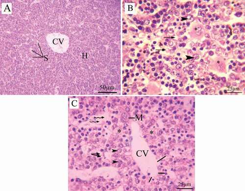 Figure 9. Photomicrographs of fetal liver sections (stained with H&E) at 20th day of gestation (A) Control group: normal structure of liver with normal hepatocyte nuclei. (B) LD group, (C) HD group: showed cytoplasmic vacuoles (arrow), vacuolated hepatocytes (head arrow), degenerated hepatocytes (asterus), Central vein with degenerated endothelial lining (lines), Megakaryocytes (M) and dilated sinusoid (wavy arrow)