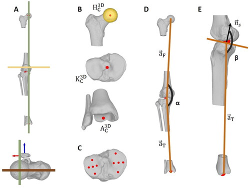 Figure 2. Manual annotation methods, as used for the ground truth annotations. (A) Alignment of the 3D models in the planning coordinate system with its frontal (brown), sagittal (gree) and axial (beige) plane. (B) Manual determination of HC3D, KC3D and AC3D in 3D. (C) The slope plane normal vector n→S is determined by fitting a plane to manually selected points on the tibial plateau. (D) The MA is defined by the angle α between a→F and a→T. (E) The TS is defined as 180° - β, with β as the angle between a→T and n→S.
