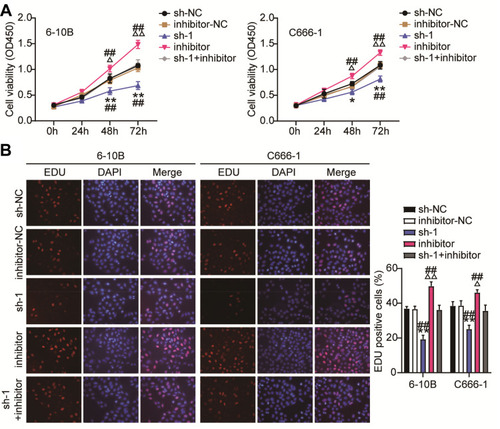 Figure 5 MiR-3940-3pp inhibitor restrains the ceRNA activity of BBOX1-AS1 on cell proliferation in NPC cells. (A) CCK8 assay examined the repressive impact of sh-BBOX1-AS1 on the proliferation of 6–10B and C666-1 cells by interact with miR-3940-3p. (B) Edu proliferation assay examined the repressive impact of sh-BBOX1-AS1 on the proliferation of 6–10B and C666-1 cells by interact with miR-3940-3pp. * P<0.05,** P<0.001, vs sh-NC; ΔP<0.05, ΔΔP<0.001 vs inhibitor-NC; ## P<0.001 vs sh-1+inhibitor.