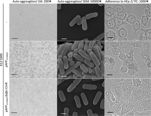 Fig. 4 Nonpathogenic E. coli K12 C600 carrying pAFP12-05829 exhibits autoaggregation, pili structures, and adhesion to HEp-2 cells.The autoaggregation and aggregative adherence to HEp-2 epithelial cells are shown for K12 C600, K12 C600 (pAFP12-05829) and its respective afp deletion plasmid. Light microscopy (LM) images with 200-fold magnification (scale bar 100 µm), scanning electron microscopy (SEM) images with 50,000-fold magnification (scale bar 500 nm) and phase contrast microscopy images (PC) with 1000-fold magnification (scale bar 25 µm) are shown