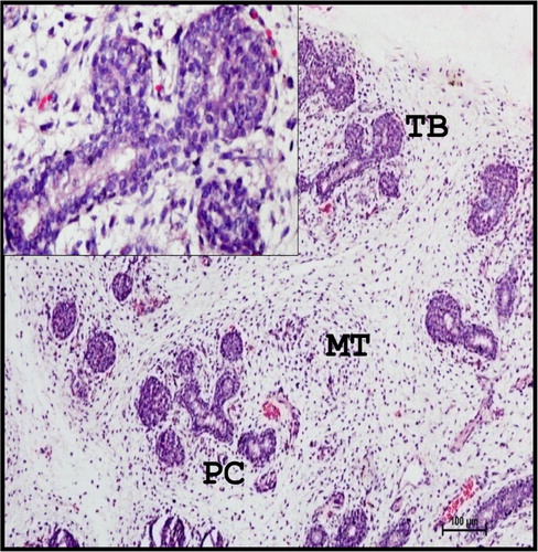 Figure 1. Photomicrograph of 11.5 cm CVRL (80th day) buffalo foetus showing groups of luminized, multilayered TB and primary cords (PC) with loose mesenchymal tissue (MT) in mandibular gland. Haematoxylin and Eosin method ×100.