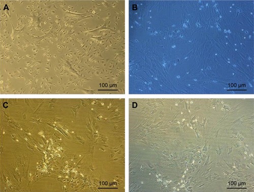 Figure 3 Morphological changes in bone marrow-derived mesenchymal stem cells (BM-MSCs) after treatment with 5-azacytidine and zebularine.