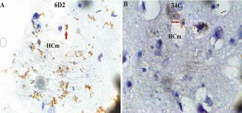 Figure 10. Photomicrograph of Pigeon (Columba livia) medial hippocampus immunoreaction; (a) showed the agrin proteoglycan expression; (b) reveal the ryanodine receptor expression. Bar: A-B = 20 µm