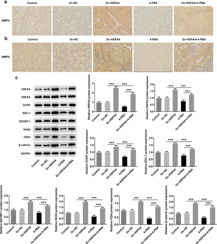 Figure 8. HSPA4 overexpression induces metastasis, ER stress and Syntenin/SOX4/Wnt/β-catenin pathway in TNBC mice. (a) (b), Levels of MMP2 and MMP9 were evaluated by immunohistochemical staining. Original magnification 200 ×. (c) Western blot assay was performed to identify the protein expressions of HSPA4, HSPA5, CHOP, SDC-1, SDCBP-1, SOX4, FZD4 and β-catenin in mice tissues. Data are expressed as mean ± SD. ***P < 0.001.