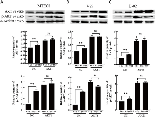 Figure 6 The impact of AKT overexpression on the effects of TRT on p-AKT and total AKT levels. The p-AKT and AKT levels in MTEC1 (A), V79 (B), and L-02 (C) cells in the 6 Gy and 6 Gy+TRT groups were assessed by Western blotting, and results were analyzed by GraphPad Prism 8. *P < 0.05, **P < 0.01.