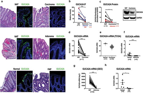 Figure 1. Loss of GUCA2A expression in tumors in human colorectum.(a-c) GUCA2A protein quantified by (a-b) immunofluorescence or (c) immunoblot (a representative immunoblot is displayed) in adenocarcinomas (sporadic and FAP), adenomas, and normal mucosa. Where appropriate, matched normal adjacent tissues (NAT) and tumors from the same patient are highlighted with a connecting line. Corresponding H&E images (a) highlight histological changes associated with transformation. (d) GUCA2A mRNA quantified by RT-PCR in adenocarcinomas and matched normal mucosa (n = 17). (e) GUCA2A mRNA expression quantified by RNASeq in adenocarcinomas (n = 339) and normal mucosa (n = 51) from human colorectum from the TCGA database.Citation36 (f) GUCA2A mRNA quantified by RT-PCR in tubular adenomas (9) and normal mucosa (n = 8). (g) GUCA2A mRNA expression quantified by RNASeq in adenomas and matched normal mucosa (n = 32) from the human colorectum from a GEO dataset (accession number GSE8671).Citation37-Citation39 (h) GUCA2A mRNA quantified by RT-PCR analysis in FAP adenomas (n = 5) and normal mucosa (n = 6). Green, GUCA2A; blue, DAPI. *, p < .05; **, p < .01; ***, p < .001, ****, p < .0001. Scale bar = 100 µm.