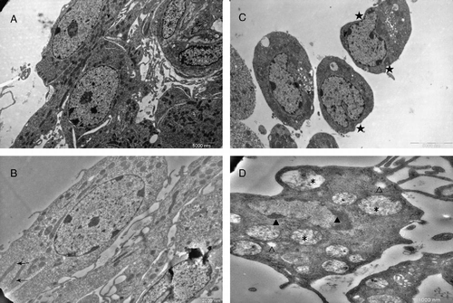 Figure 2.  Electron micrograph of apoptotic Leydig cells from control and stressed rats. The rats in the stress group were exposed to CUS, and the control group was undisturbed during the experiment. Testes from rats in both the stress group and the control group were removed, and the ultrastructure was observed by TEM. Leydig cells in the control group (A and B) had typical ultrastructural characteristics associated with this cell type: abundant smooth endoplasmic reticulum in the cytoplasm ( → ) and heterochromatin rimmed beneath the nuclear membrane. The Leydig cells in stressed rats displayed some morphological changes of early apoptosis. Cell shrinkage (star in C), condensation of nuclear chromatin (▴ in D), mitochondria swelling (* in D) and mitochondria vacuolar degeneration were found in Leydig cells from stressed rats (C and D). There were many vesicles (open triangle in D) in the cytoplasm of Leydig cells from stressed rats. Magnification: A and C, bar = 5000 nm; B, bar = 2000 nm; and D, bar = 1000 nm.