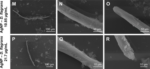 Figure 6 Images obtained by TEM of the larvae of Ancylostoma spp., treated with ivermectin (A–C), levamisole (D–F), AgNO3 solution (G–I), AgNP (chemical synthesis) (J–L), AgNP (Duddingtonia flagrans) 10.85 µg/mL (M–O), and AgNP (D. flagrans) 21.7 µg/mL (P–R). Amplification: 160× for D; 190× for J, P; 230× for G; 250× for A, M; 2,000× for R; 2,200× for E, H; 2,500× for C, F, I, K, L, N, O, Q; and 11,000× for B.Abbreviations: AgNPs, silver nanoparticles; TEM, transmission electronic microscopy.