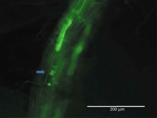 Figure 5. Structures in the roots of Periconia macrospinosa-inoculated tomato plants visualised using a specific FISH probe labelled with Alexa Fluor 488. Blue arrow: growing microsclerotium. Roots were screened using the EVOS™ FL Cell Imaging System (Life Technologies, CA, USA).