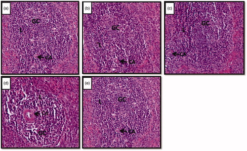 Figure 2. (a–e) Photomicrographs of the cross sections of the spleen showing the island of white pulp. Note the shrinkage of island of the white pulp region and germinal center in stressed rats (d) compared to control (a), vehicle control (b), unstressed + Vacha extract (c) and stress + Vacha extract (e) treated rats. 200× (H&E). GC: germinal center; CA: central artery; L: lymphocytes.