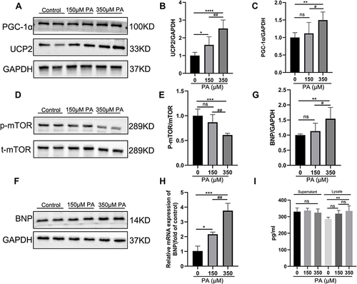 Figure 5 P-mTOR was decreased, and PGC-1α-UCP2-BNP was increased in PA-inducted impaired cardiomyocytes. (A) The protein expression levels of PGC-1α and UCP2 in the MCMs stimulated with PA for 24 h. GAPDH was used as standard. (B and C) Quantified protein levels of PGC-1α and UCP2 (measured by Fusion). (D and E) The protein expression levels of p-mTOR and mTOR were analyzed after PA (0, 150, 350 μM) stimulated MCMs for 24 h. (F and G) The protein expression levels of BNP were analyzed by Western blotting, and GAPDH was used as standard. (H) The mRNA levels of the cell damage marker gene BNP after being treated with PA in cardiomyocytes. (I) BNP content in cell supernatant and lysate was measured by ELISA Kit. *P < 0.05, **P < 0.01, ***P < 0.001, ****P < 0.0001 vs the control or 0 μM PA, #P < 0.05, ##P < 0.01 vs the 150 μM PA group.