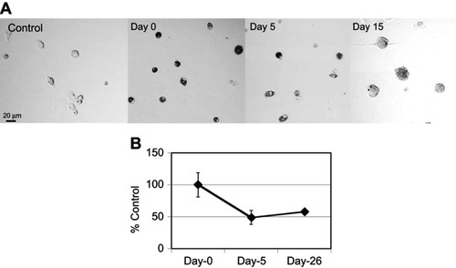 Figure S2 Degradation of ox-SG-CNTs in Kupffer cells. (A) Confocal microscopy DIC images of control Kupffer cells and that incubated with ox-SG-CNTs for 24 h (Day 0), and at Day 5 and Day 15. CNTs appear as black spots. Scale bar, 20 µm. (B) The intracellular ox-SG-CNT levels in Kupffer cells at various time points were estimated from the optical absorbance of cell lysate at 750 nm. Data represent the percentage of SG-CNTs relative to the starting concentration and are expressed as the mean ± SD of three independent replicates.Abbreviations: DIC, differential interference contrast; ox-SG-CNT, super-growth carbon nanotubes after treatment with H2SO4/HNO3 for about 40 min at 70oC.