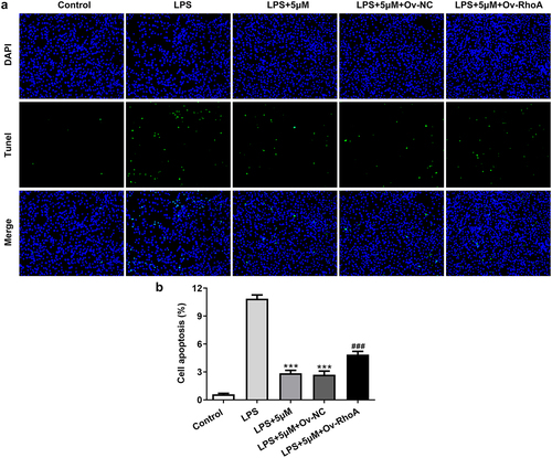 Figure 4. Carvedilol reduces apoptosis of LPS-induced BEAS2B cells by inhibiting RhoA/ROCK activities. (a-b) The apoptosis of LPS-induced BEAS2B cells transfected with Ov-RhoA. ***P < 0.001 Versus LPS. ###P < 0.001 Versus LPS+5 µM+Ov-NC.