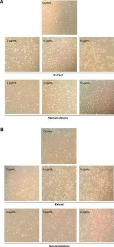 Figure 6 Morphological changes in A549 lung cancer cells.Notes: Change after 24 hours (A), and 48 hours (B) of treatment with curcuminoid nanoemulsions and Curcuma longa extract, as captured using Nikon TS100-F microscope at 10×10 magnification. Control represents the cells incubated with medium only.