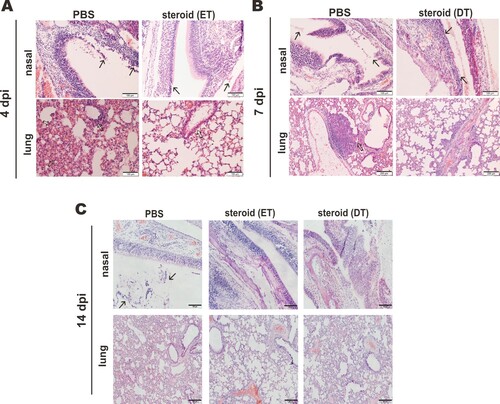 Figure 3. Impact of steroid on the histopathological changes in nasal turbinates and lungs of SARS-CoV-2-infected hamsters. Representative images of nasal turbinate and lung sections of SARS-CoV-2-infected hamsters were shown. Hamsters were intranasally inoculated with 105 PFU of SARS-CoV-2 and then treated with methylprednisolone at 2 dpi (early steroid treatment, ET) or 5 dpi (delayed steroid treatment, DT). Histopathological changes in nasal turbinate and lung tissues were examined by hematoxylin and eosin staining. (A) Images at 4 dpi. Nasal turbinate tissue in PBS treatment control hamster showed severe epithelial desquamation and submucosal infiltration (arrows). The lung tissue showed diffuse alveolar wall thickening, blood vessel congestion, patchy area of alveolar space infiltration, exudation and patchy area of lung consolidation with two adjacent blood vessels showing vasculitis (open arrows). In ET group, respiratory and olfactory epithelium was intact, with mild submucosal infiltration observed in respiratory epithelium (arrows). In the lung tissue, only peribronchiolar infiltration and patchy area of alveolar wall thickening were observed (open arrows). Scale bar, 100 μm. (B) Images at 7 dpi showing histopathological changes in nasal turbinate and lung tissues from hamster receiving DT at 5 dpi. Nasal turbinate of the PBS control still showed some exudation mixed with cell debris in the nasal cavity (arrows), while the nasal epithelium showed prominent cell proliferation in steroid-treated hamster indicating tissue repairment (lower, arrows). Scale bar, 100 μm. The lung of PBS control hamster showed focal hemorrhage and patchy proliferative consolidation (open arrows); while in steroid-treated hamster, the lung still had mild perivascular infiltration but only very small foci of cell proliferation (open arrows). Scale bar, 200 μm. (C) Images at 14 dpi. Nasal turbinate tissue in PBS control hamster still showed mild degree intra-epithelium infiltration and submucosal blood vessel congestion. Luminal secretion with cell debris was occasionally observed (arrows). While nasal turbinate tissues showed intact epithelial layers, no apparent immune cell infiltration or luminal secretion was seen. Scale bar, 100 μm. The lung tissue in PBS control showed diffuse alveolar wall thickening and blood vessel congestion with no alveolar space infiltration or exudation. Upon early (ET) or delayed (DT) steroid treatment, the lung tissue showed only focal area of mild alveolar wall thickening and vessel congestion. Scale bar, 200 μm.