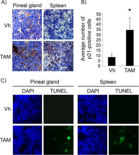 FIG 1 Tamoxifen treatment restores p53 activity in pineal glands in vivo. (A) Representative immunostaining for p21Cip1 in pineal gland sections and spleen of Irbp-Cyclin D1, p53ER(TAM)Ki/− mice that underwent irradiation after treatment for 6 days (P10 to P16) with vehicle (Vh) or tamoxifen (TAM) as indicated. (B) Number of p21-positive cells per field under the conditions shown in panel A. Each point represents the means from 2 independent experiments. Bars represent standard deviations, and an asterisk denotes a statistically significant difference (P < 0.05). (C) Representative TUNEL staining (green) and corresponding DAPI nuclear stain (blue) under the same conditions as those for panel A.