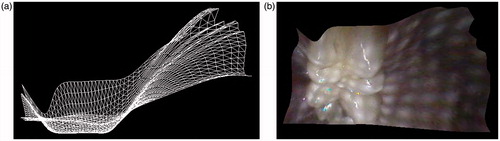 Figure 2. Range images of the maxillary first molar produced by the present system. The coordinate values of the cusp were recorded for all 30 frames, and the standard error was calculated. The left and right figures show the range images of the maxillary first molar by mesh and texture, respectively.