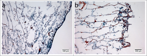 Figure 2. Masson's trichrome staining used for histological analysis of the collagen sponges, in which the 3D gingival tissue had been reconstructed in vitro. The tissue was co-cultured for 24 h with hydroxyapatite discs without (a) or with the biofilm (b).