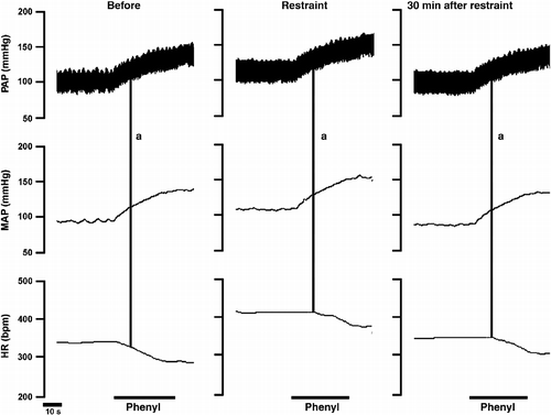 Figure 4  Typical recording from one representative rat illustrating reflex bradycardia in response to a blood pressure increase caused by intravenous phenylephrine (phenyl) infusion before, during (Restraint) or 30 min after ending (30 min after restraint) the acute restraint stress. Vertical lines (a) indicate an increase of 10 mmHg in MAP and the corresponding reflex bradycardia showing rightward displacement of the response during and 30 min after acute restraint stress. PAP, pulsatile arterial pressure and HR, heart rate.