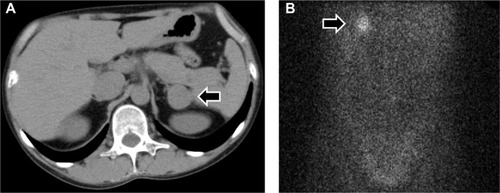 Figure 2 Radiological findings.