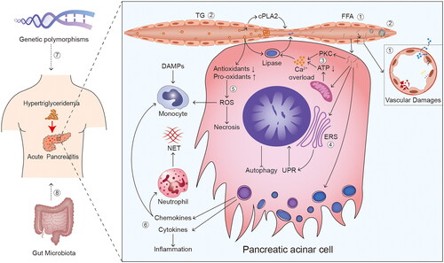 Figure 1. Overview of potential mechanisms of hypertriglyceridaemia induced and aggravated AP. ① free fatty acids (FFAs) and ② microcirculatory disorder are considered vital factors in the mechanisms of hypertriglyceridaemia (HTG) induced acute pancreatitis (AP). microcirculatory disorder is primarily characterised by injuries caused by vasoconstriction/vasospasm, deceleration of blood flow, and blockage of blood vessels. ③ calcium (Ca2+) overload, ④ endoplasmic reticulum stress (ERS), ⑤ oxidative stress, ⑥ chemokines and cytokines, ⑦ genetic polymorphisms, and ⑧ gut microbiota are considered the potential mechanisms of HTG aggravated AP. Reactive oxygen species (ROS) are the main acting components in oxidative stress. Abbreviation: TG: triglyceride; cPLA: cytoplasmic phospholipase A; PKC: protein kinase C; ATP: adenosine triphosphate; UPR: unfolded protein responses; ROS: reactive oxygen species; DAMPs: damage-associated molecular patterns; NET: neutrophil extracellular trap.