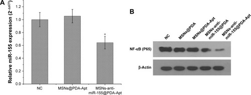 Figure 5 (A) miR-155 expression in SW480 cells treated with MSNs@PDA-Apt and MSNs-anti-miR-155@PDA-Apt detected by qRT-PCR. Data are expressed as mean ± SEM (*P<0.05). (B) Western blot analysis of NF-κB (P65) protein in SW480 cells treated with MSNs@PDA, MSNs@PDA-Apt, MSNs-anti-miR-155@PDA, and MSNs-anti-miR-155@PDA-Apt.Abbreviations: NC, negative control; MSNs, mesoporous silica nanoparticles; PDA, polymerized dopamine; Apt, aptamer; SEM, standard error of mean; NF-κB, nuclear factor kappa B; miR-155, MicroRNA-155.