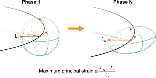 Figure 1 Illustrations for the concept of “principal strain”.Notes: The maximum principal strain is calculated based on expansion of the principal direction (L) from the starting (standard) point (phase 1) to the measured point (phase N). LN at phase N becomes large when the original sphere changes its shape strongly at phase N.