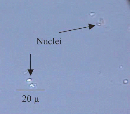 Figure 1 Crystallization “nuclei” from sample 1 (1000X).