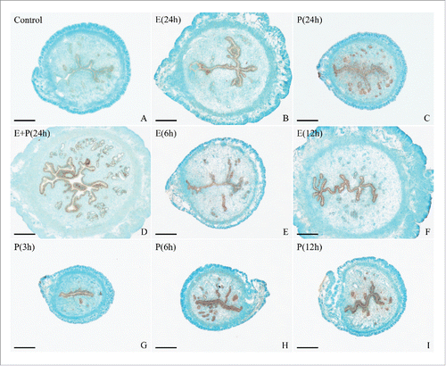 Figure 8. In situ hybridization of Hmgn5 expression after ovariectomized mice were treated with sesame oil (Control), estrogen, progesterone or a combination of estrogen and progesterone. E, estrogen; P, progesterone. Bar = 60 μm.