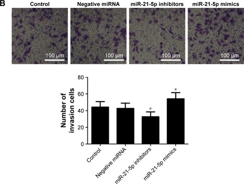 Figure 6 Analysis of the migration and invasion of SGC-7901 cells regulated by miR-21-5p assessed with wound healing and transwell assays.