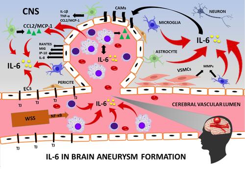 Figure 7 Suggested contribution of interleukin 6 (IL-6) to brain aneurysm formation.