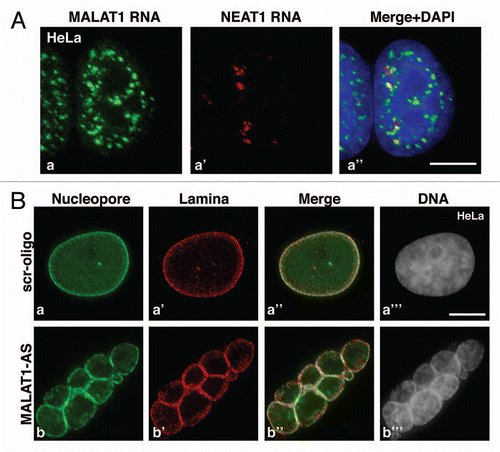 Figure 1 (A) Co-RNA-FISH using probes against MALAT1 (a, green) and Neat1 (a′, red) reveals distribution of MALAT1 and Neat1 RNA in nuclear speckles and paraspeckles respectively. (B) Depletion of MALAT1 (MALAT1-AS) in HeLa cells results in nuclear fragmentation. Note that the fragmented nuclei contain nuclear pores (green) and nuclear lamina (red). DNA is counterstained with DAPI. The bar represents 5 µm.