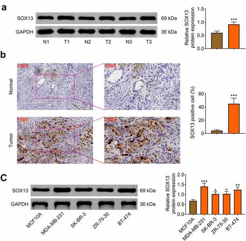 Figure 1. SOX13 is highly expressed in breast cancer tissues and cells. (a) The protein level of SOX13 in breast cancer and normal tissues measured by western blot (***p < 0.001). (b) Immunohistochemical staining of SOX13 detected by IHC (***p < 0.001). (c) The protein level of SOX13 in breast cancer cells and normal cells measured by western blot. Each bar is regarded as the mean ±SD of 3 independent experiments (***p < 0.001, **p < 0.01, *p < 0.05). ***p < 0.001, **p < 0.01, *p < 0.05 versus MCF1A.