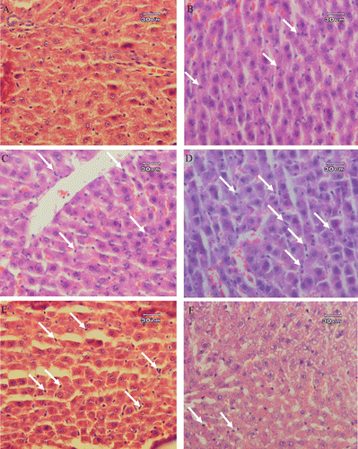 Figure 1.  Histopathological studies. Light microscopy showing histologic sections of the liver of rats from different groups. (A) Section of liver from a rat receiving laparotomy plus ethanol 30% as vehicle (sham-operated, SOP group), (B) Section of liver from a rat receiving CLP plus ethanol 30% as vehicle (CLP group), (C) Section of liver from a rat receiving CLP + 2.5 mg/kg b.w. of STW 5, (D) Section of liver from a rat receiving CLP + 5 mg/kg b.w. of STW 5 and (E) Section of liver from a rat receiving CLP + 10 mg/kg b.w. of STW 5. Arrows indicate the infiltration or sequestration of polymorphonuclear neutrophils. Sections were stained with hematoxylin and eosin (original magnification ×400).