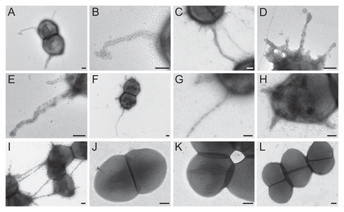 Figure 3 Immuno-EM analysis of pilus production by WT TX82 and its ebpABCfm deletion mutant and complementation derivates. (A) TX82 grown on BHI plate; (B) higher magnification of the pilus seen in (A); (C) TX82 grown in BHI broth, showing two cells possibly connected by a pilus; (D) TX82 grown in TSBG; (E) TX82 grown on a blood agar plate; (F–I) Complemented ebpABCfm deletion mutant (TX82ΔebpABCfm (pAT392::ebpABCfm)) grown in BHI broth. Note the pili apparently linking several cells in (I); (J) TX82ΔebpABCfm grown in BHI broth; (K) TX82ΔebpABCfm (pAT392) grown in BHI broth; (L) TX82 grown in BHI broth. (A–K) were stained with affinity-purified EbpCfm-specific antibodies and (L) with pre-immune antibodies.Citation30 Scale bars 200 nm.