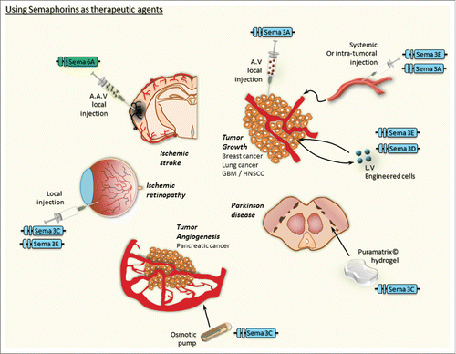 Figure 1. Using semaphorins as therapeutic agents. This cartoon is illustrating the major pathological conditions in which semaphorins have been shown to produce a potential therapeutic effect. The delivery mode is mentioned for each experimental in vivo models. AV, Adenovirus; AAV, Adeno-associated virus; LV, Lentivirus.