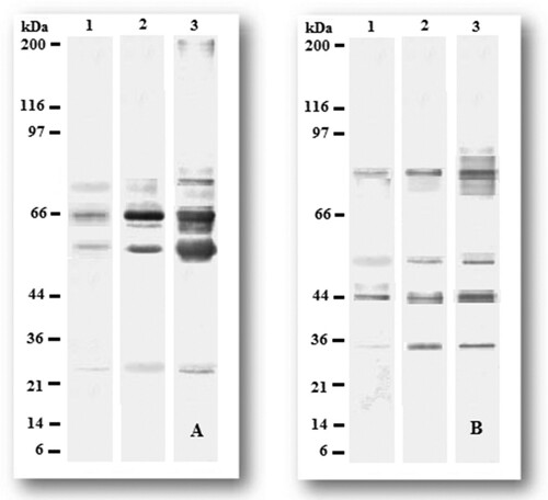 Figure 5. Western blot analysis on pooled (A) P. aphanidermatum and (B) F. oxysporum antigens from different stages of infection. Proteins were electrophoresed and blotted onto PVDF membranes and incubated with sera (1:1000 dilution). Band pattern for the isolates are as follows: Lane 1: pooled antigens isolated at stage I infection; Lane 2: pooled antigens isolated at stage II infection; Lane 3: pooled antigens isolated at stage III infection. Molecular weight of standard protein is indicated on left margin.