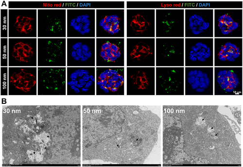 Figure 4 Internalization of LDH of all sizes in NPCs. (A) Cellular uptake of 30 nm, 50 nm, and 100 nm LDH in organelles of mitochondria and lysosomes. (B) TEM images of intracellular LDH of all sizes (black arrows) in NPCs.