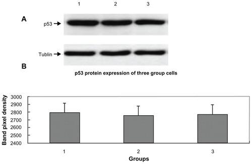 Figure 6 p53 protein expression for the cells from the three groups. (A) Lane 1, lane 2, and lane 3, respectively, show the p53 expression of pcDNA3.1-DCN, control, and empty vector groups. The results were representative of three repeated experiments. (B) Densitometric analysis was done using Lab image software.