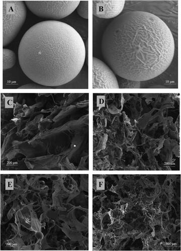 Figure 4. Scanning electron microscopy photograph. (A) E2-MS (502H). (B) E2-MS (503H). (C) HAECM scaffold (5 mg/ml). (D) HAECM scaffold (8 mg/ml). (E) E2-MS-HAECM scaffold with high magnification. (F) E2-MS-HAECM scaffold with low magnification.