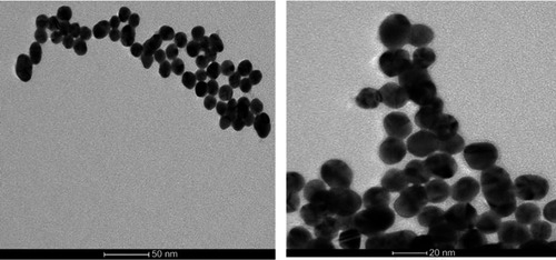 Figure 1 Characterization of AuNPs by transmission electron microscope (TEM): TEM micrographs of AuNPs showed the presence of dark-colored spherical nanoparticles of high atomic mass within the size range 25±3.