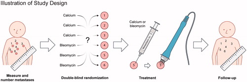 Figure 1. Illustration of study design At first visit, metastases were numbered and measured. Data were then brought to an external unit (the pharmacy) who randomized and mixed calcium chloride and bleomycin into syringes labeled with numbers according to the metastases. At treatment, the blinded contents of the syringes were injected intratumorally and followed by electroporation. It was a once-only treatment and the patients were followed for 6 months with regular evaluation of tumor response and safety.