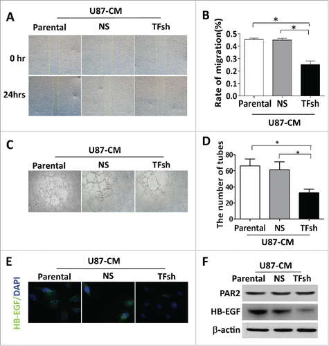 Figure 3. TF inhibition in tumor cells decreased ECs migration and vascularization in vitro. (A, B) Wound healing assay. Migration of endothelial cells (ECs) cultured with conditioned medium (CM) was measured by closure of scratched wound. Quantification of migration was expressed as the ratio of wound closure at 24 hours to 0 hour (HPF; × 200). (C, D) Tube formation assay of ECs cultured with CMs demonstrated that CM from TF expression cells induced ECs vascularization in vitro. Data represented at mean ± SD from 5 independent experiments. (E) Representative images and (F) protein levels of HB-EGF, PAR2 in ECs. ECs were cultured for 24 h with various CM, including CMs. β-actin served as loading control for western blotting.