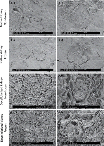 Figure 5. Scanning electron microscopy images of frozen/thawed and non-frozen kidney samples at 250X (A1-D1) and 500X (A2-D2) magnifications. No microstructural damage was detected after freezing/thawing. Renal corpuscles, distal and proximal tubules all were preserved during freezing/thawing cycles.