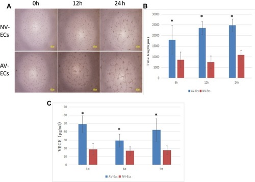 Figure 5 Angiogenesis of AV-ECs and NV-ECs. Tube formation assay of AV-ECs and NV-ECs at 6 h, 12 h and 24 h (A). The tube length was measured by using Image J (B). VEGF concentration was detected by ELISA (C). Data are mean ± SD (n=3). *P<0.05 between AV-ECs and NV-ECs.