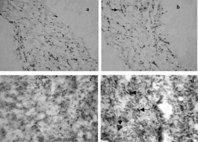 Figure 3 Histology and immunohistochemistry of equivalents at 1 week after grafting into rats. A) H + E staining of DE, no microvessel-like tubes were seen (original magnification × 100). B) H + E staining of EDE, microvessel-like tubes were observed (arrow) (original magnification × 100). C) Immunohistochemistry of DE, no cells had CD31 reactivity (original magnification × 250). D) Immunohistochemistry of EDE, both CD31 positive microvessel-like tubes (vertical arrow) and CD31 positive individual cells (horizontal arrows) were seen (original magnification × 250).