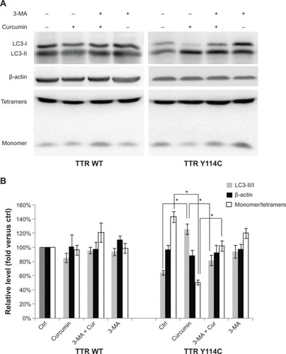 Figure 3 Protective effect of curcumin on TTR Y114C could be partially blocked by 3-MA.